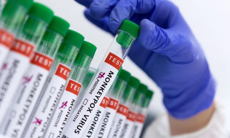 Uberlândia tem 52 casos de varíola dos macacos